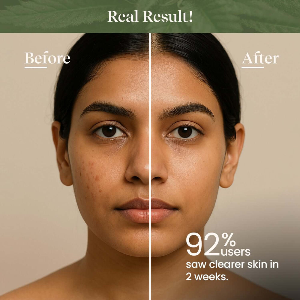 Skincare serum and beauty products used in a daily skin barrier care routine